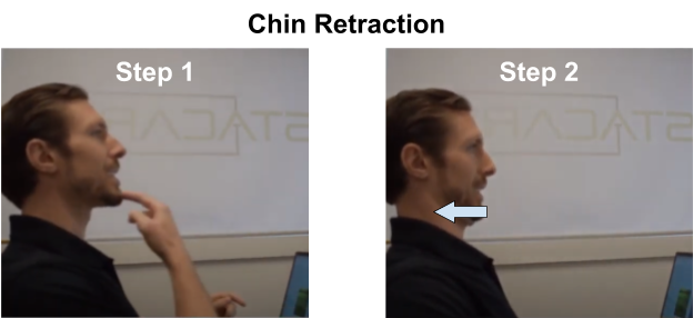 Chin Retraction Demonstration Image